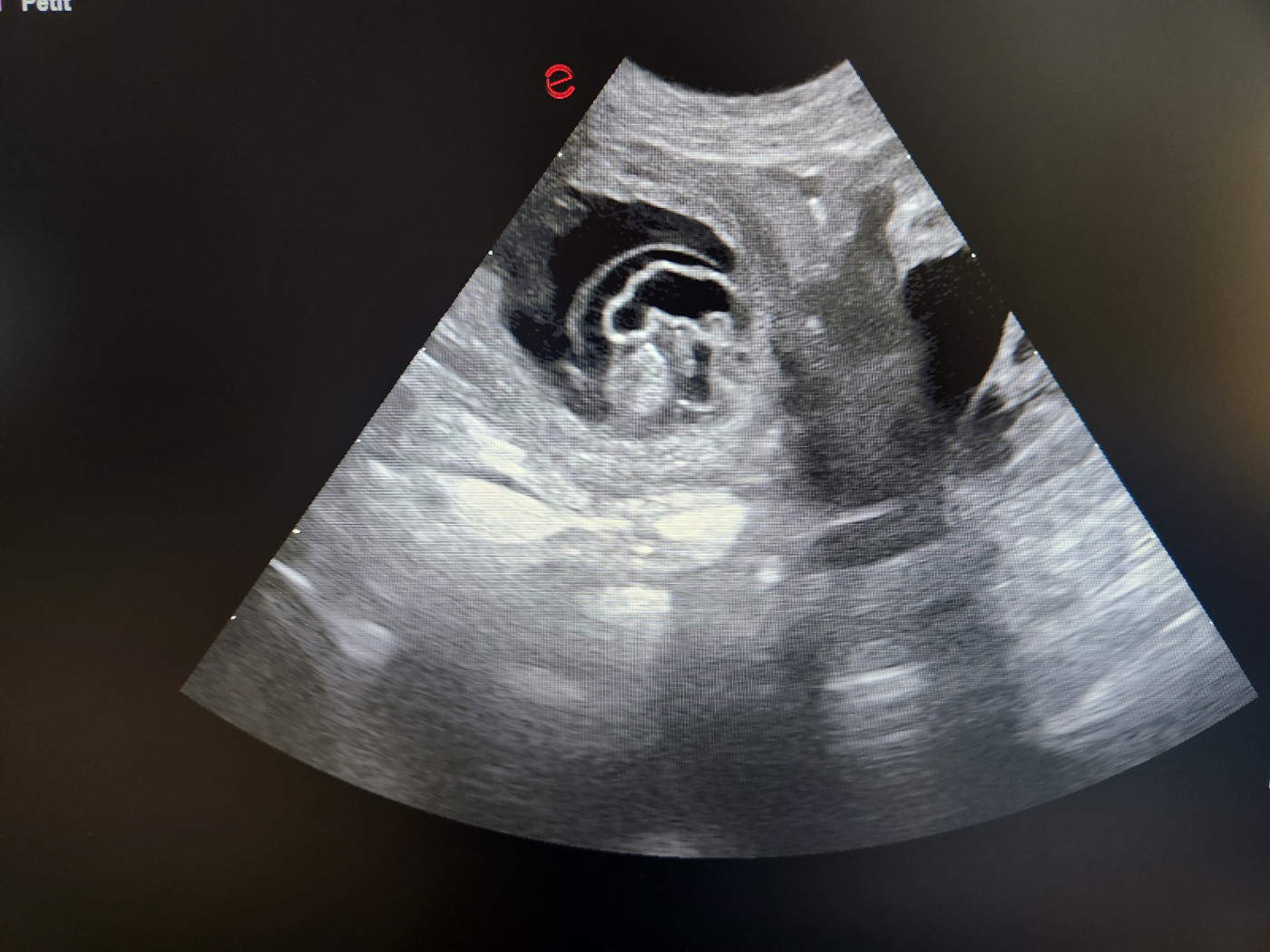Des bébés dans 10 jours